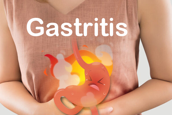 Cuida tu Salud Gastrointestinal: Consejos practicos